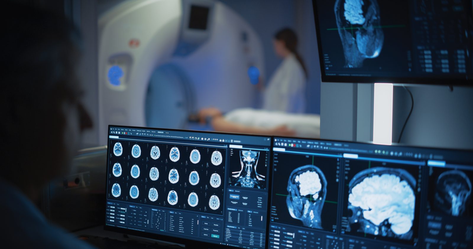 An MRI scanner and reporting workstation at a partner imaging centre